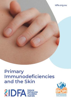 PIDs and the Skin